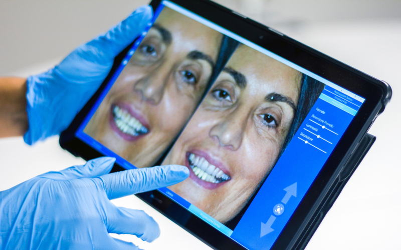 Clínica Santa Zita Medicina Dentária - Branqueamento