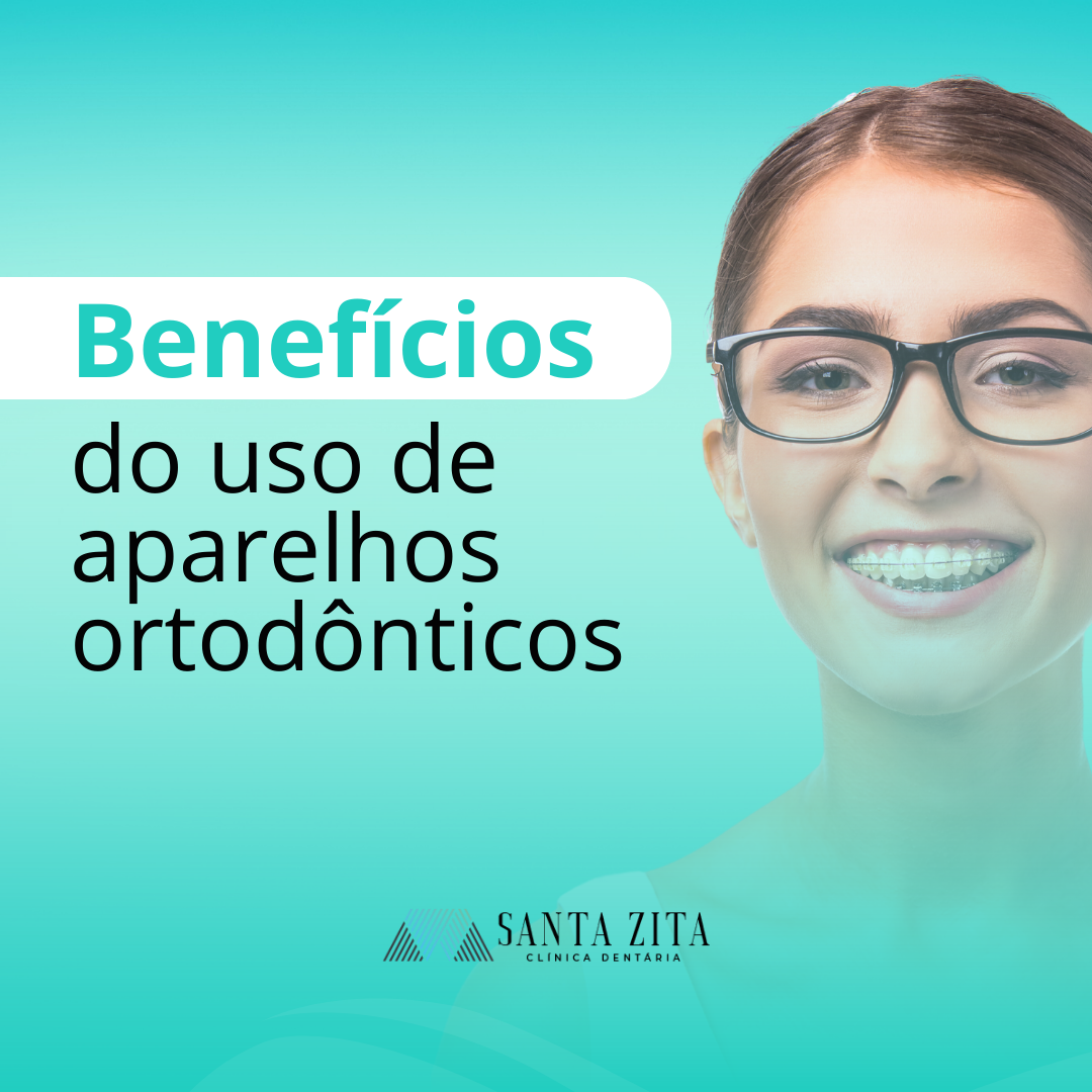 Aparelhos Ortodônticos - Clinica Santa Zita