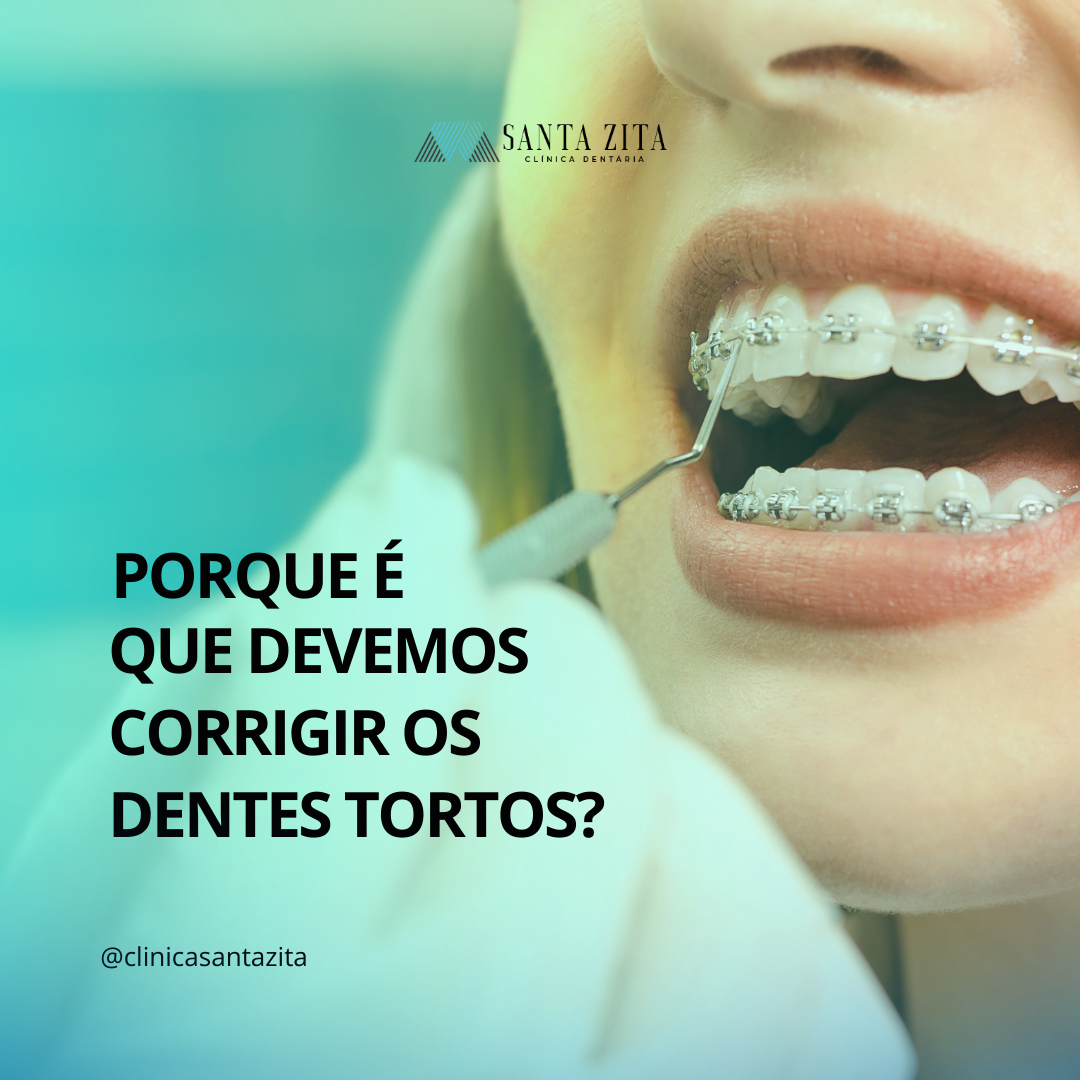 Clínica Santa Zita - Corrigir Dentes Tortos