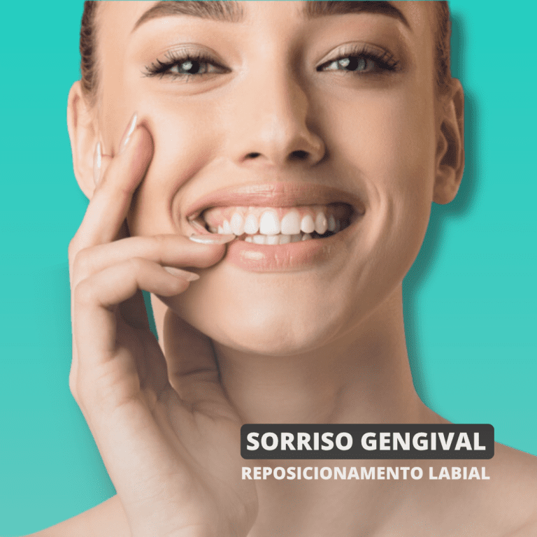Corrigir Sorriso Gengival - Clinica Santa Zita