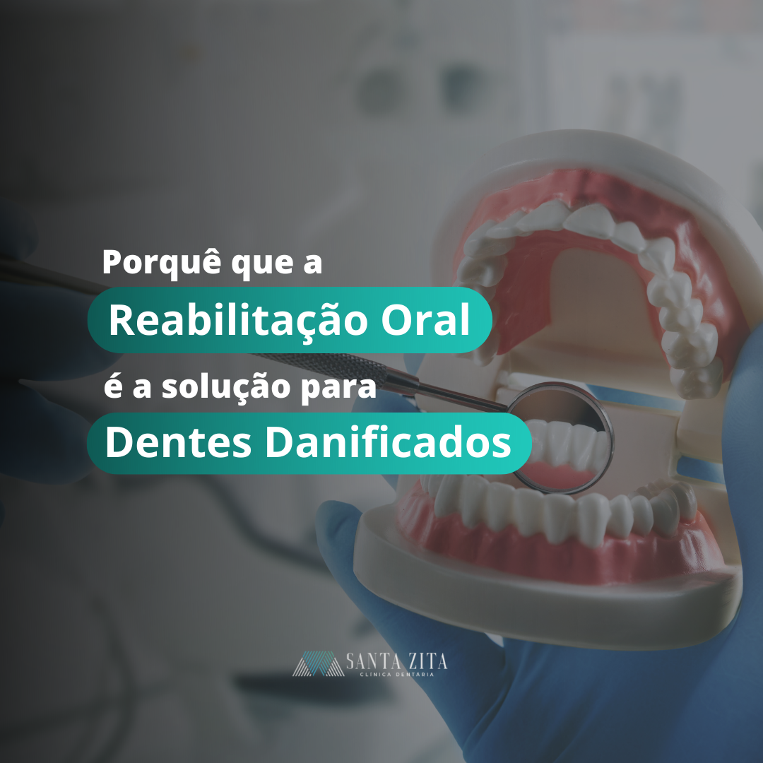 Clinica Santa Zita - Dentes Danificados