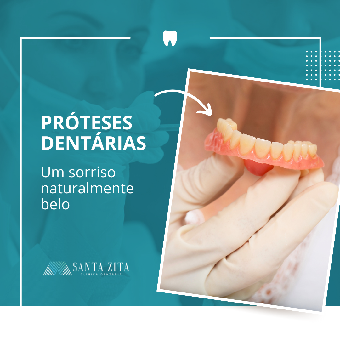 Próteses Dentárias - Clinica Santa Zita