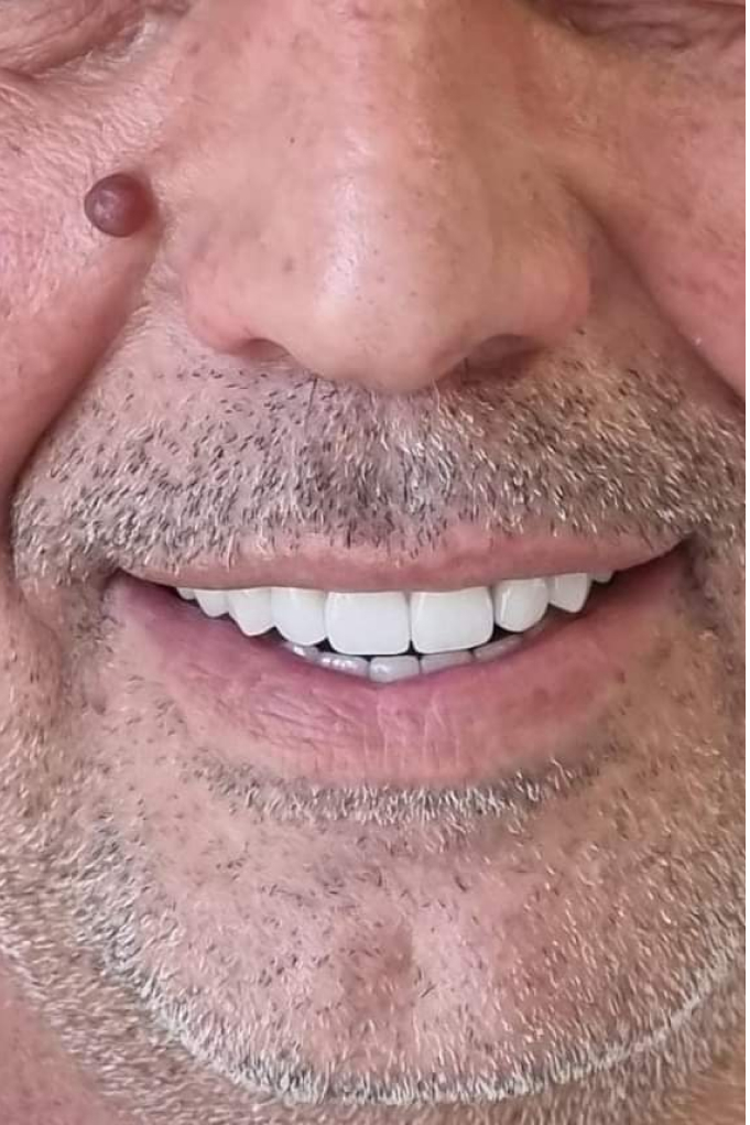 Prostodontia Clinica Santa Zita