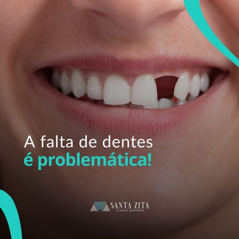 Clinica Santa Zita - Implantes Dentários