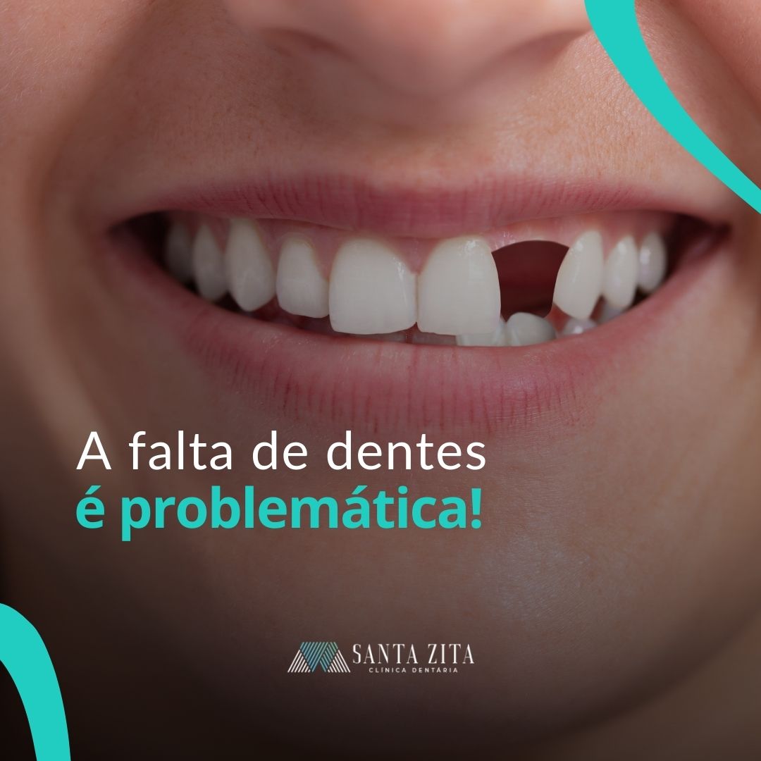 Clinica Santa Zita - Implantes Dentários Clinica Santa Zita - Implantes Dentários