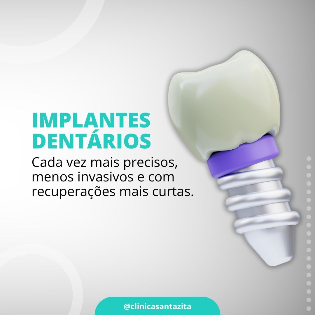 Implantes Dentários cada vez mais precisos