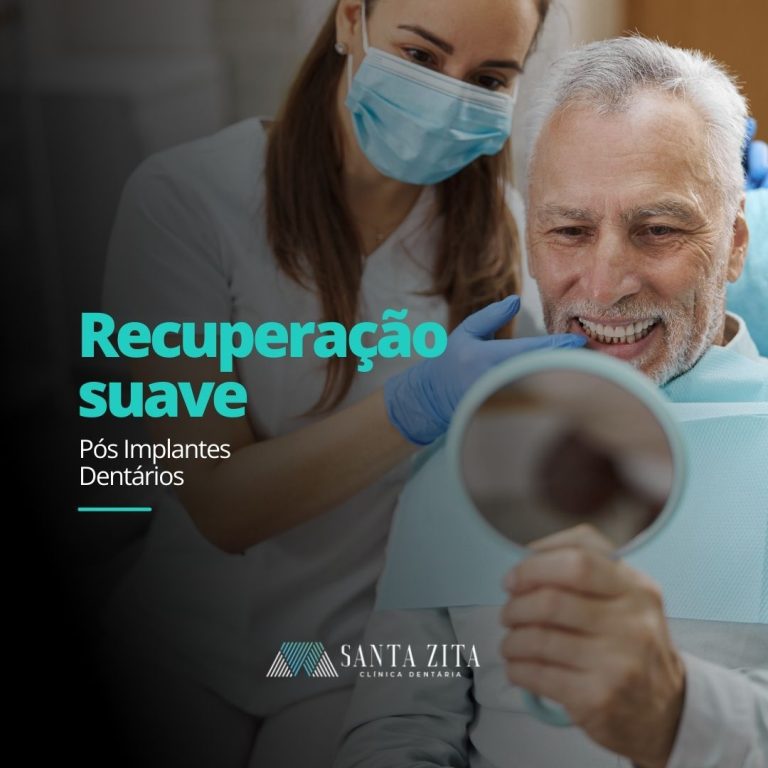 Clinica Santa Zita - Implantes Dentários
