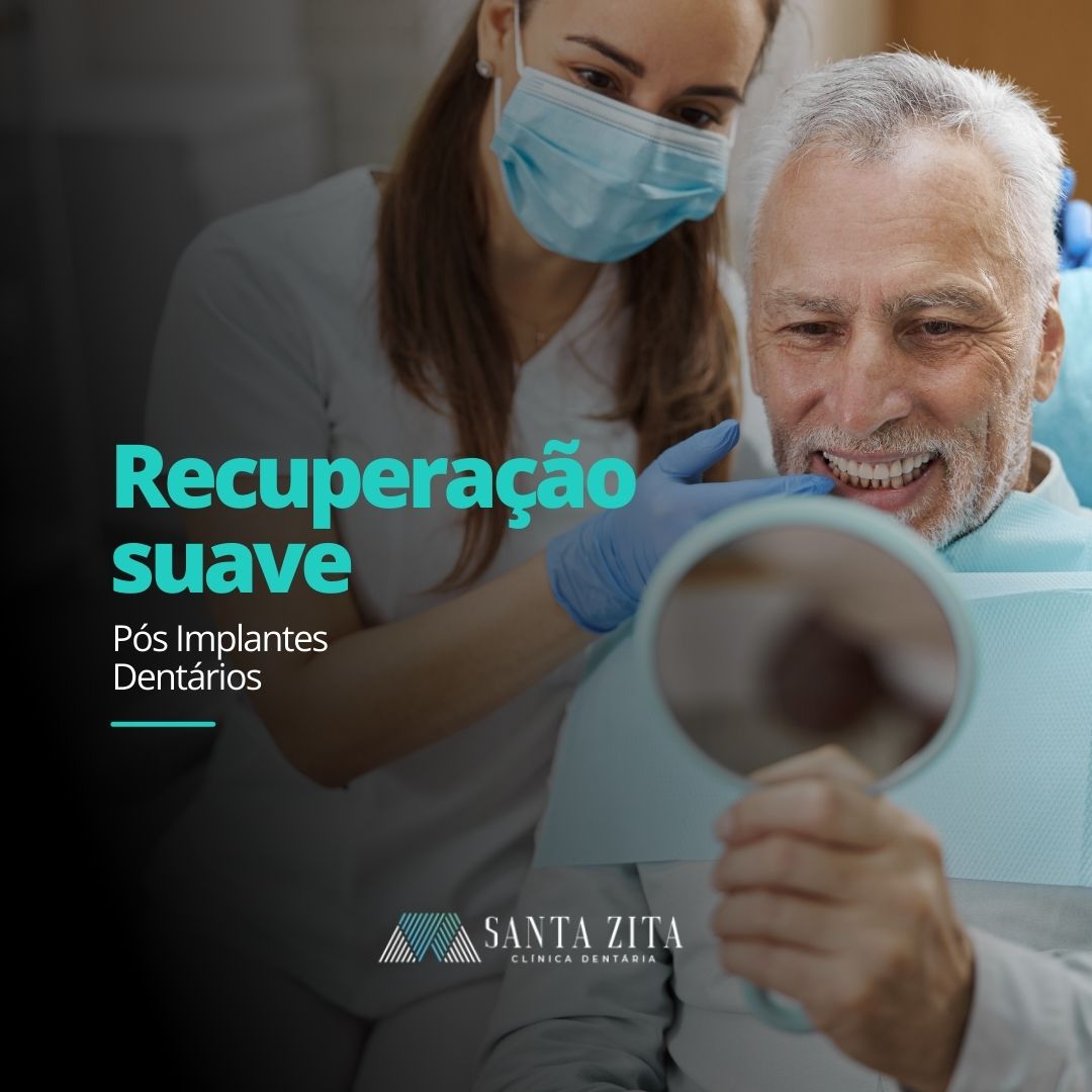 Clinica Santa Zita - Implantes Dentários